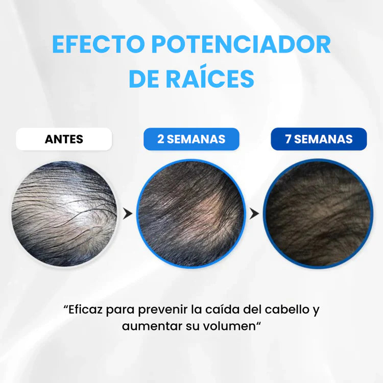 Scalpy - Ampolla para la Regeneración del Cabello